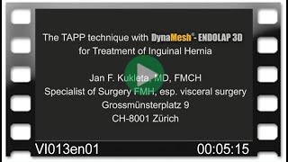 DynaMesh®-ENDOLAP 3D - OR-Video: The TAPP Technique for Treatment of Inguinal Hernia