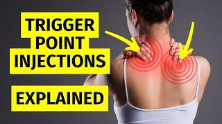 Myofascial Pain Trigger Point Injections Explained