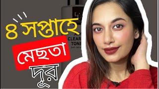 ৪ সপ্তাহে মেছতা দূর॥W Skin Laboratory Anti Melasma Series