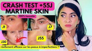 MARTINE SKIN SUR 55J CA DONNE QUOI ?