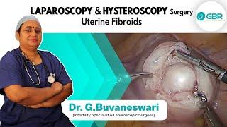 Laparoscopy & Hysteroscopy Surgery | Uterine Fibroids | Dr G Buvaneswari | GBR Clinic