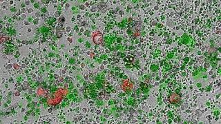 Monitoring tumor cell killing and IFNg production by T cells on xCELLigence RTCA eSight