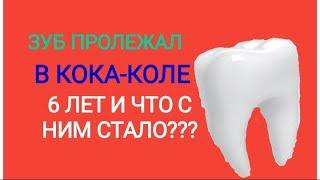 ЗУБ ПРОЛЕЖАЛ В КОКА-КОЛЕ 6 ЛЕТ ЧТО СНИМ СТАЛО???