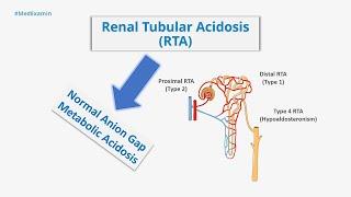 Renal Tubular Acidosis (RTA) - Types of RTAs & Their Differences