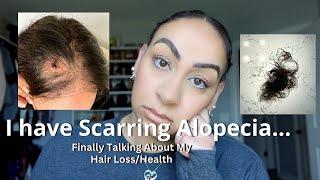 Finding Out I Have Scarring Alopecia | Health/Hair Loss Update