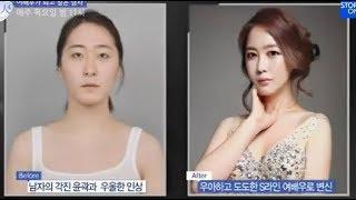 [View Plastic Surgery Korea Review] Let me in TV Show, FFS in Korea (1)