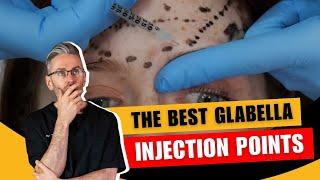 Injecting the glabella. Injection Points & Safety Advice