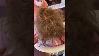 Hairdresser shares horrific LICE INFESTATION on girl's head  Part Two