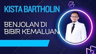 Kista Bartholin | Benjolan di Bibir Kemaluan