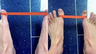 Bunion or Hallux Valgus Exercises