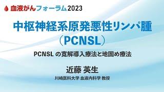 【BCF2023】中枢神経系原発悪性リンパ腫（PCNSL）