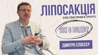 Що таке ліпосакція? | Дмитро Слоссер