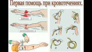 ОБЖ, 7 класс. Первая помощь при наружных кровотечениях