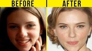 5 Best Celebrity Nose Jobs In Hollywood (Before And After)