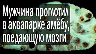 Мужчина проглотил в аквапарке амёбу, поедающую мозги