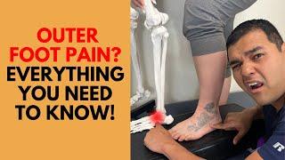 Outer Foot Pain - Everything You Need To Know About Cuboid Syndrome