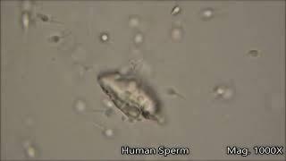 Humam sperm under the microscope 1000X zoom