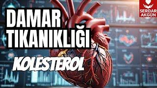 Damar Tıkanıklığı, Kolesterol, Sağlık, Prof.Dr.Serdar Akgün,