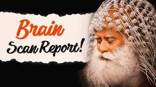 What ADVANCED MEDITATION Does To SADHGURU’S BRAIN?