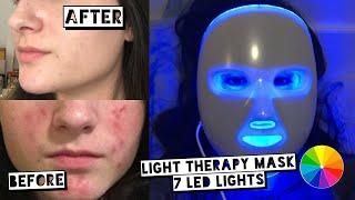 TESTING LED LIGHT THERAPY MASK FOR ACNE | PROJECT E BEAUTY LED REJUVENATION MASK