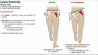 Trendelenburg Test | Rationale & Interpretation