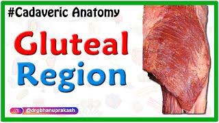 Gluteal region - Cadaveric Anatomy