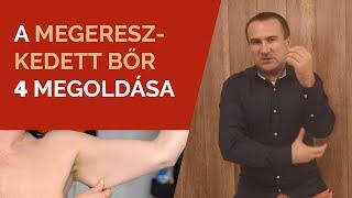 A megereszkedett bőr 4 megoldása