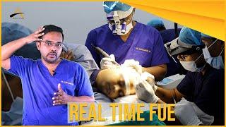 Real Time FUE - A Revolutionary Technique to Treat Baldness #DrAloksahoo