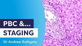 PBC and Staging | Dr Andrew Bathgate