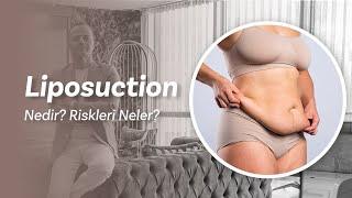 Liposuction Nedir? Ne Kadar Zayıflatır? Riskleri Neler? | Op. Dr. Ercan Demirbağ