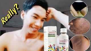 HOW TO WHITEN FACE, ARMPITS AND GROINS  IN JUST 5 DAYS | SKINMATE SHARK OIL |