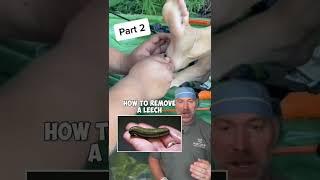 Removing a Leech the Right Way 🩸 #shorts