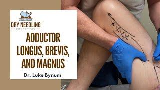 Dry Needling Adductor Longus/Brevis and Magnus