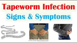 Tapeworm Infection Signs & Symptoms, Nutrient Deficiencies, & Complications