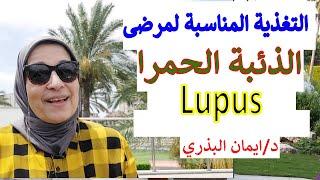 الذئبة الحمرا | Lupus | الأطعمة المفيدة  و الاطعمه الضارة | التغذية المناسبه