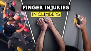 Finger Injuries in Climbers | Lattice Training X Sheffield Climbing Clinic - Part 1