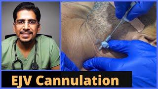 EJV (External Jugular Vein) Cannulation (in 5 mins)