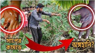 অঙ্গহানির জন্য দায়ী এই সাপ! Russell's Viper Fatality | বিশাল চন্দ্রবোড়া সাপ!@SnakeSaverBrothers