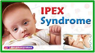 IPEX syndrome / Immunodysregulation polyendocrinopathy enteropathy X-linked Syndrome #usmle #mbbs