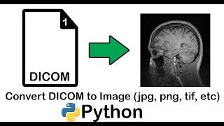 How to Convert a DICOM file into an Image (jpg, png, tif, etc) using Python | Single File |