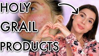 MY HOLY GRAIL SKINCARE PRODUCTS THAT TOTALLY SAVED MY SKIN..