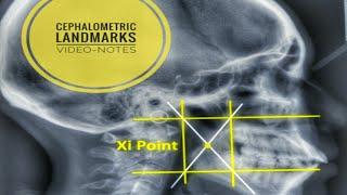 Cephalometric Landmarks and their definition