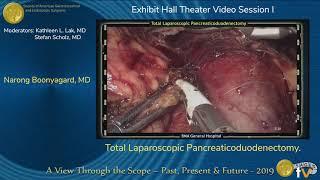 Total Laparoscopic Pancreaticoduodenectomy