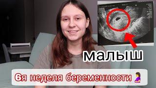 6 я Неделя Беременности | Первое УЗИ | Токсикоз | Усталость