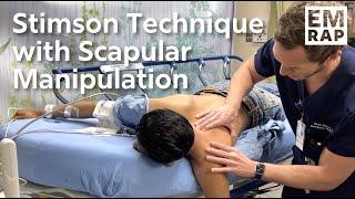 Stimson Technique with Scapular Manipulation