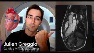 Cardiac MRI Planning - Full Guide (Part 1)