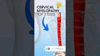 Cervical Myelopathy Top 3 Tests #physiotherapy #physicaltherapy #medical