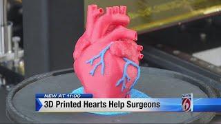 11pm 3D Printed Hearts Help Surgeons