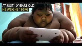 The world's fattest boy who weighs 192 kilos at the age of 10