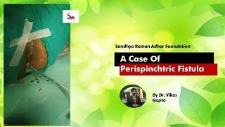 A case of Perispinchtric Fistula By Dr. Vikas Gupta From Sandhya Raman Adhar Foundation